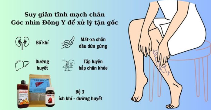 suy giãn tĩnh mạch