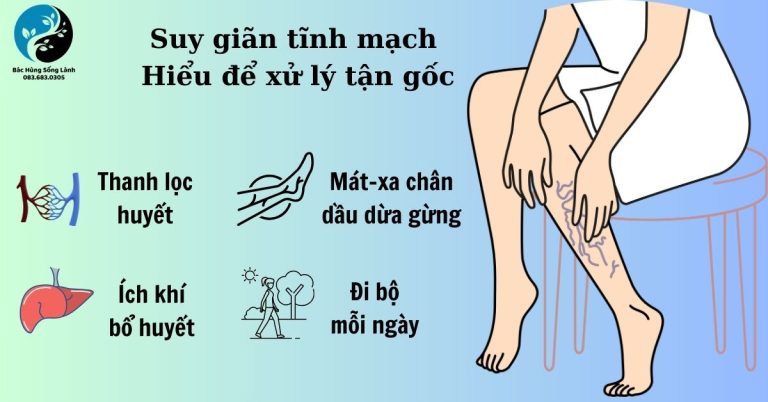 Suy giãn tĩnh mạch