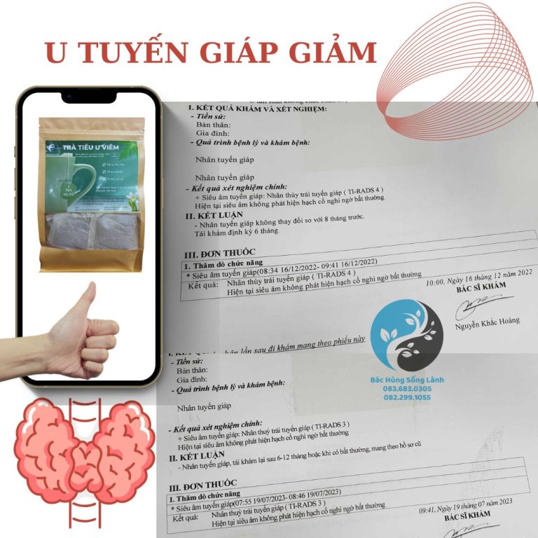 U TUYẾN GIÁP GIẢM