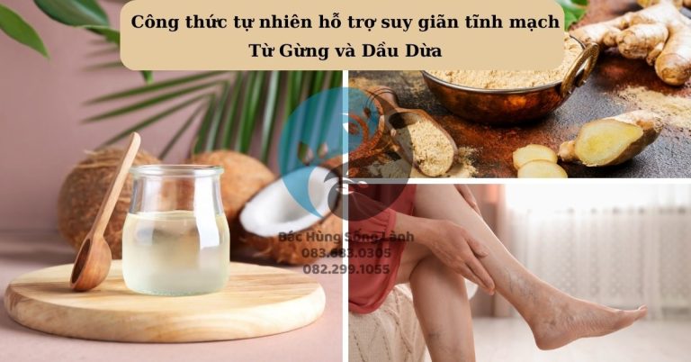 Công thức tự nhiên hỗ trợ suy giãn tĩnh mạch