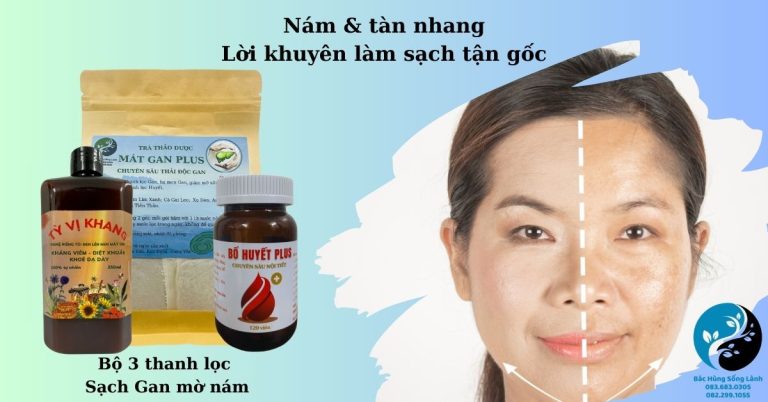 Nám & tàn nhang – Lời khuyên làm sạch tận gốc