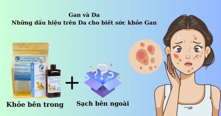 Những dấu hiệu trên Da cho biết sức khỏe Gan