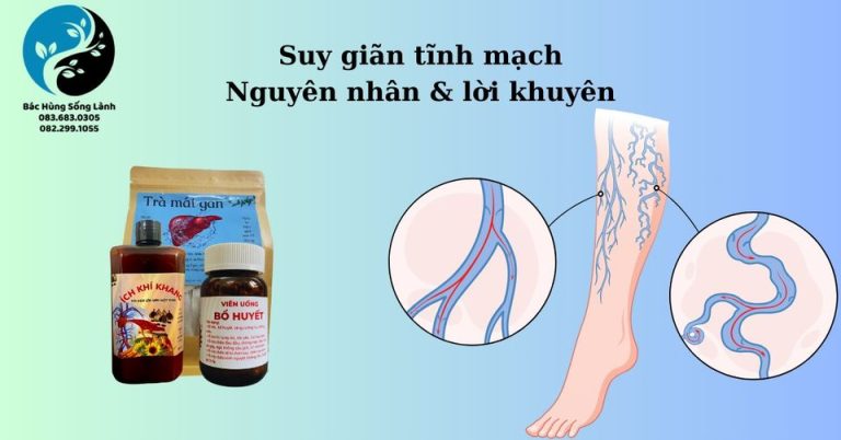 Suy giãn tĩnh mạch | Nguyên nhân & lời khuyên